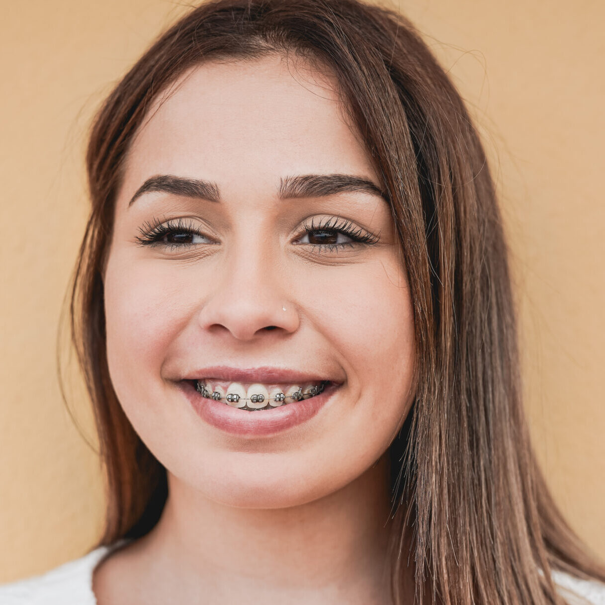 braces dentist in Geelong at Dental Spa Geelong
