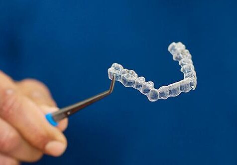 Orthodontic Mould