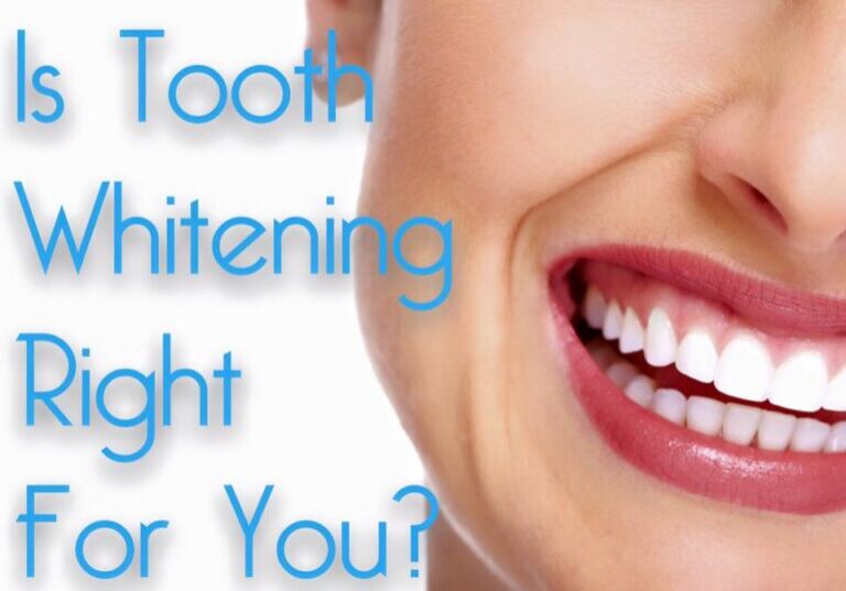 Whitening Blog 3