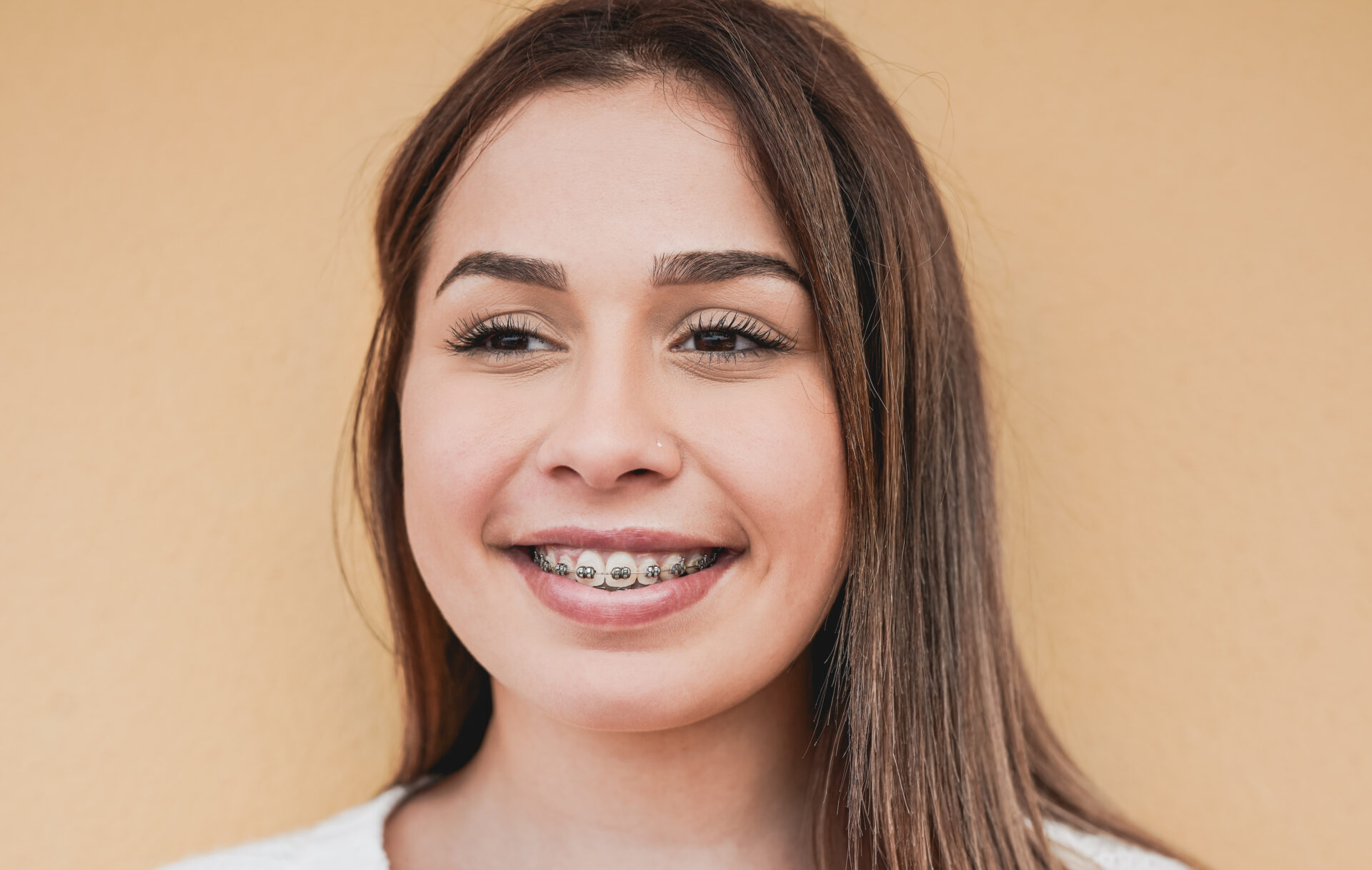 braces dentist in Geelong at Dental Spa Geelong