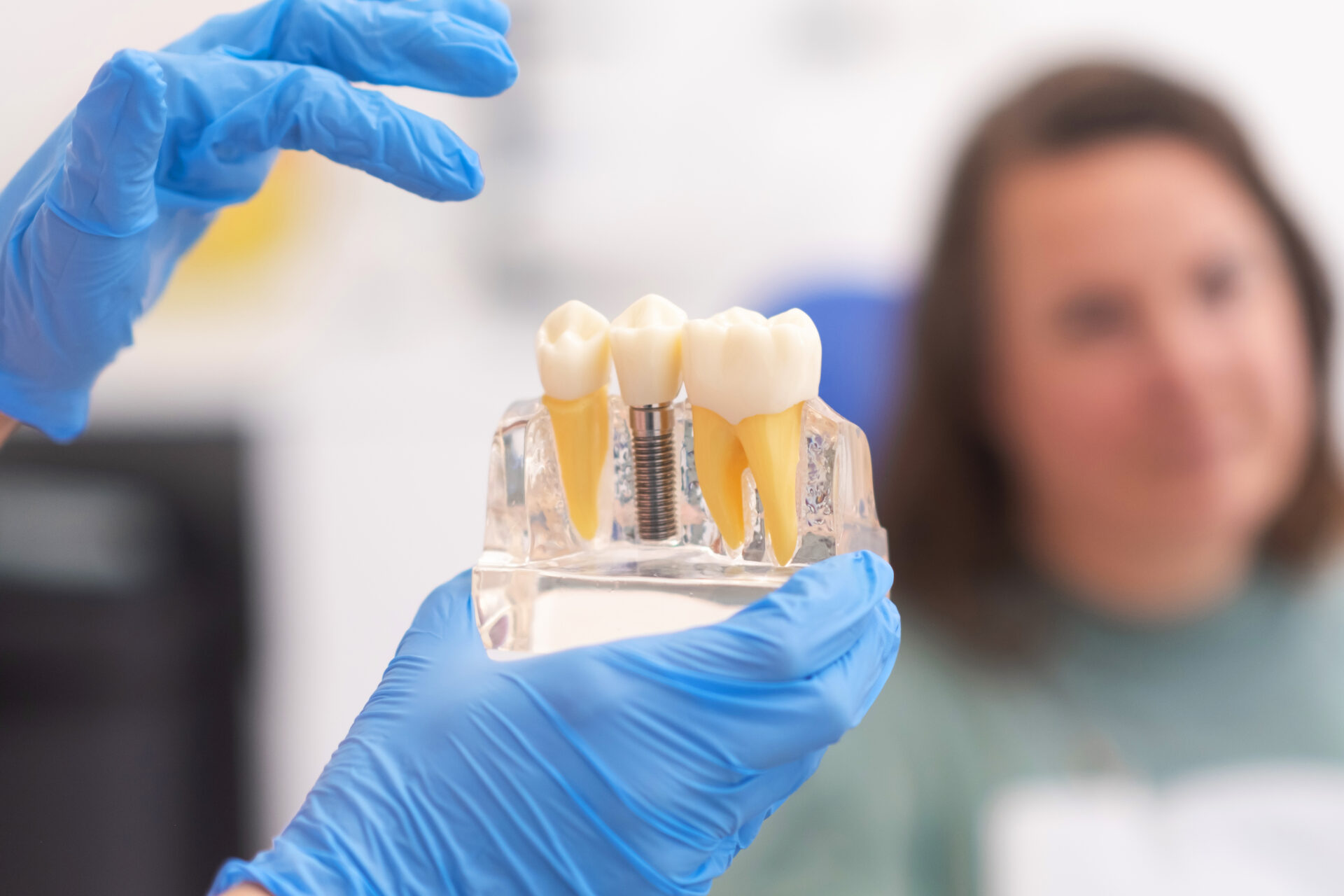 implant dentist Geelong demonstrating dental implants at Dentalspa Geelong